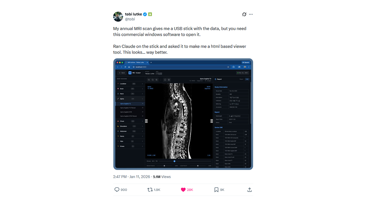 The Shopify CEO Built His Own MRI Viewer. That's Not the Story.
